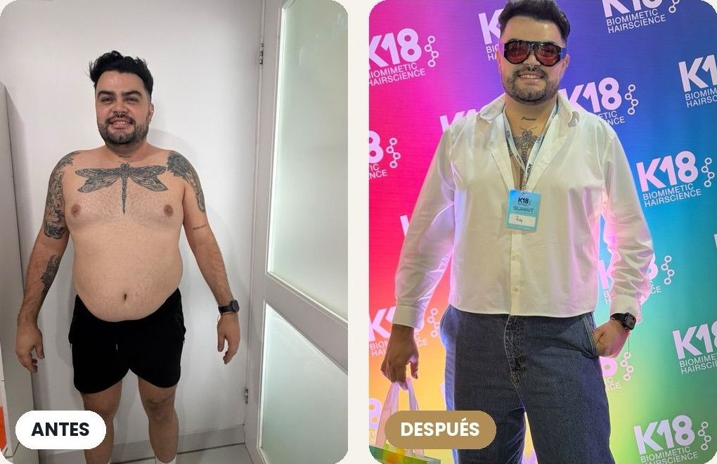 Antes y después de un paciente de Mediclinic