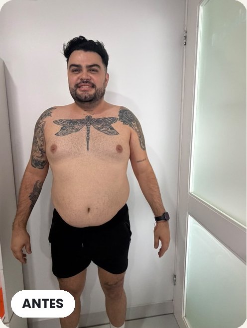 Paciente Mediclinic antes del programa de pérdida de peso